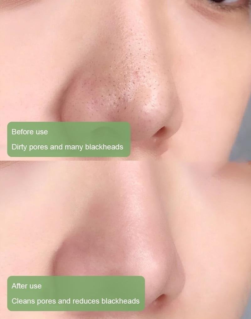 🍵Buy 1 Get 1 Free🍵 Deep Cleanse Green Tea Mask