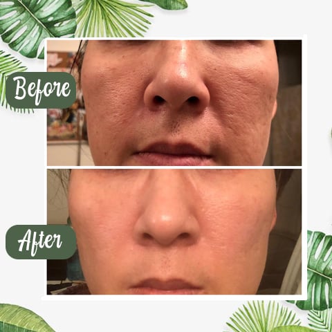 Last Day Promotion 49% OFF - 🔥Green Tea Deep Cleanse Mask
