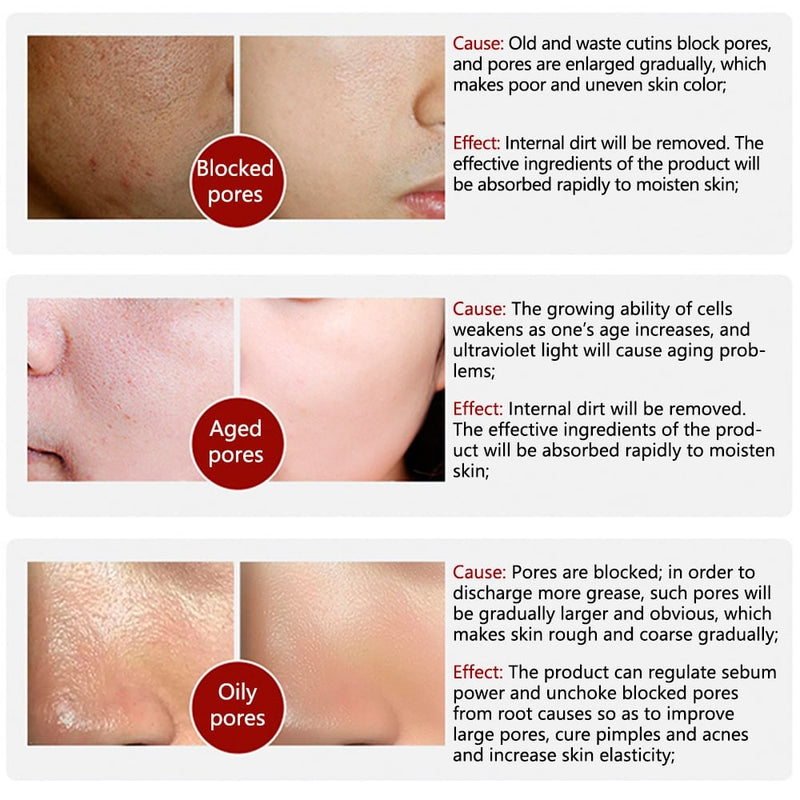 (💥BUY 1 GET 1 FREE⏰) 2024 New Magical Pore Eraser Waterproof Face  Primer Stick