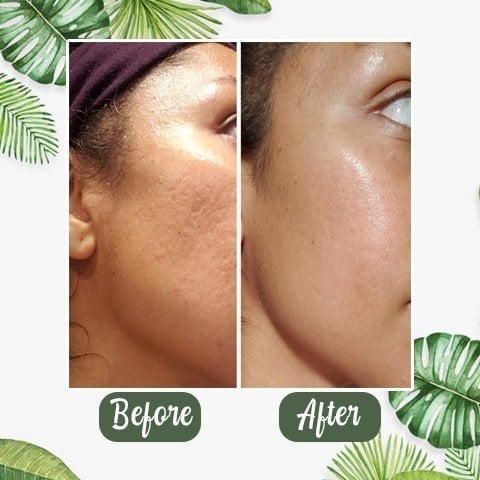 🍵Buy 1 Get 1 Free🍵 Deep Cleanse Green Tea Mask